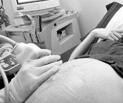 En nuestro pas se registran 64 embarazos cada 1.000 adolescentes.