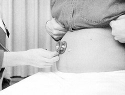 Entre el 25% y el 35% de los embarazos no deseados son producto de la falla en el método anticonceptivo utilizado.