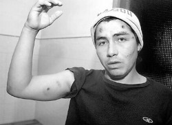 Julio Acua tambin fue vctima de los perdigones policiales. Lo balearon en el rostro, en el pecho, y en un brazo cuando se cubri.