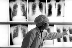Entre un 30 y un 35% de la población mundial está infectada por el bacilo de la tuberculosis.
