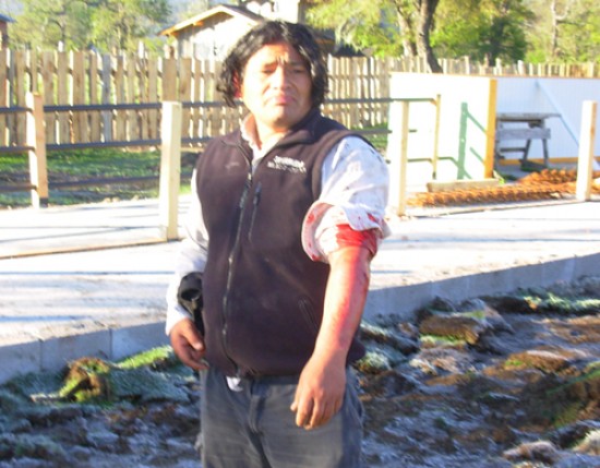 Juan Copa, integrante de la familia que vive en el lote hace aos, fue herido en un brazo.