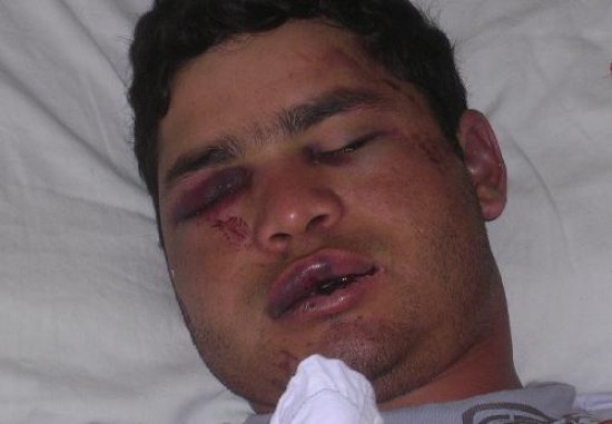 Francisco Contreras no alcanz a escapar de los violentos y fue brutalmente golpeado, especialmente cuando estaba tirado en el suelo.
