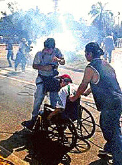 Policas arrojaron gases contra personas en sillas de ruedas.