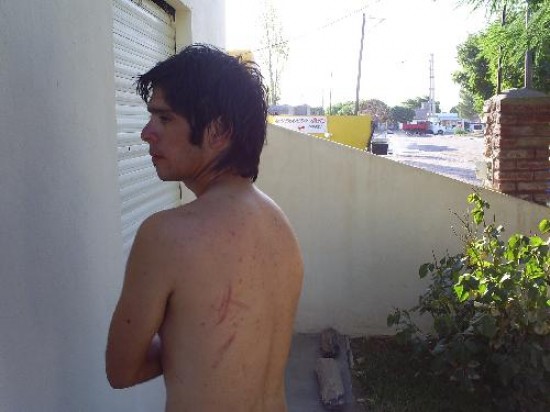 Juan Huaracn dijo que conoca a los policas y que recibi golpes en la espalda y en una de sus nalgas. 