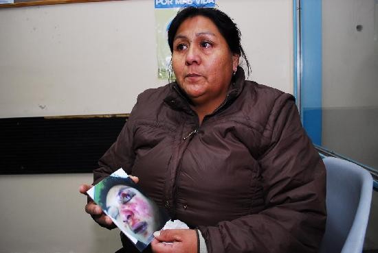La madre de la joven muestra la foto de su hija, con la cara desfigurada. 