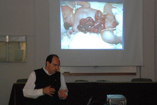 El mdico Svetliza dio una conferencia en el Colegio Mdico donde explic la intervencin al beb, que tena los intestinos fuera del cuerpo. 