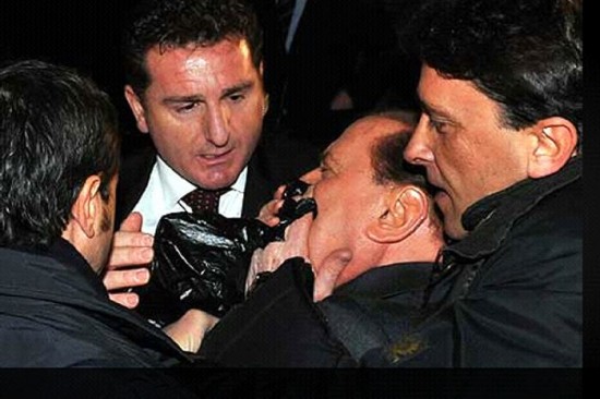 Berlusconi, retirado por su custodia luego de la agresin. Massimo Tartaglia, el agresor. Sin antecedentes penales. El premier italiano, minutos despus del golpe. 